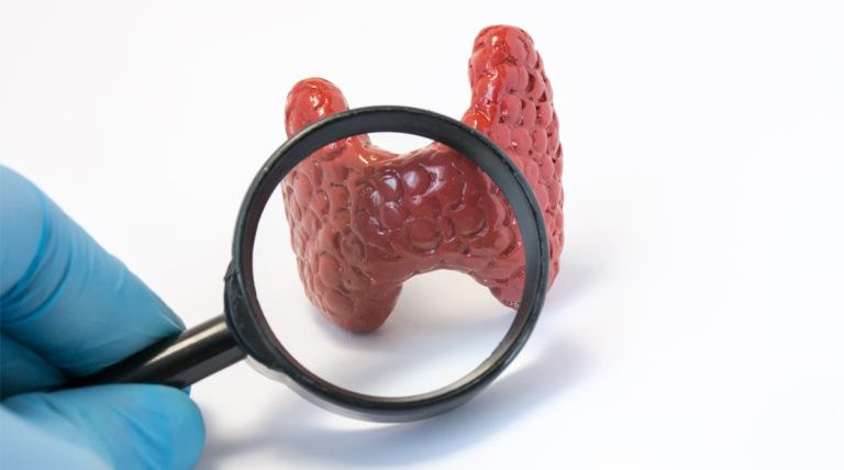 Triiodothyronine (T3) Test | Thyroid Function Assessment